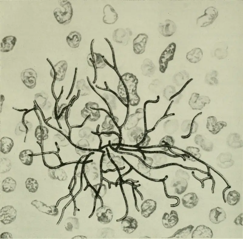 Actinomycetes (A filamentous Prokaryote)