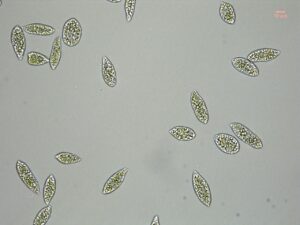 (Euglena Facts) – 10 Fascinating Facts About Euglena In Detail