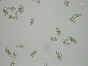 Euglena gracilis