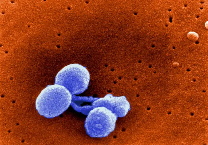 Streptococcus pneumoniae (A non-motile prokaryote)