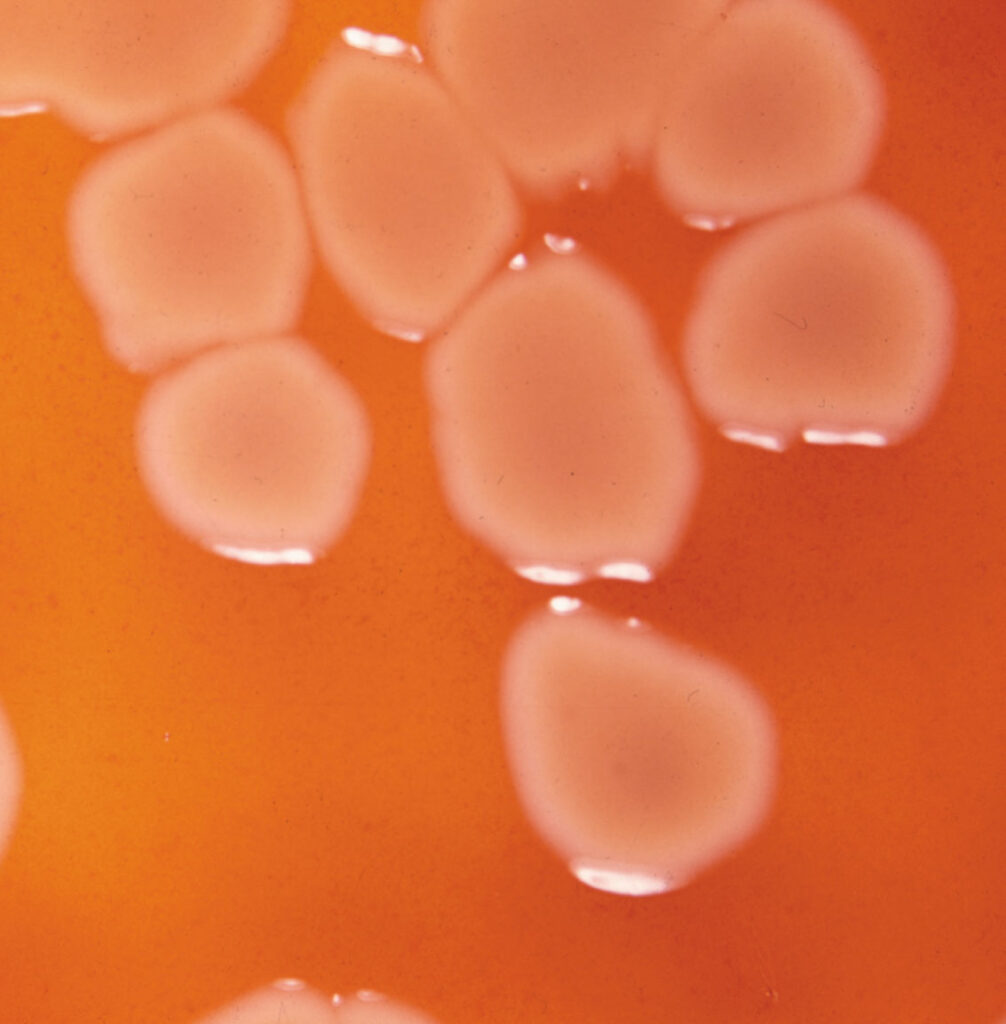 Pseudomonas aeruginosa bacteria from urine