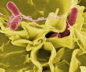 bacteria, salmonella, pathogens, disease, electron microscopy, electron micrograph, science, magnification, coliform, enterobacteriaceae, escherichia, infection, infect, infected, danger, contagious, risk of infection, vaccination, bacteria, bacteria, bacteria, bacteria, bacteria, salmonella, salmonella, salmonella