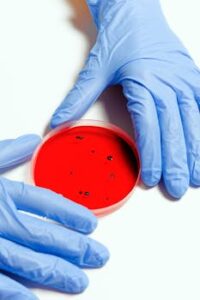 Laboratory setting with latex gloves holding a petri dish for research.